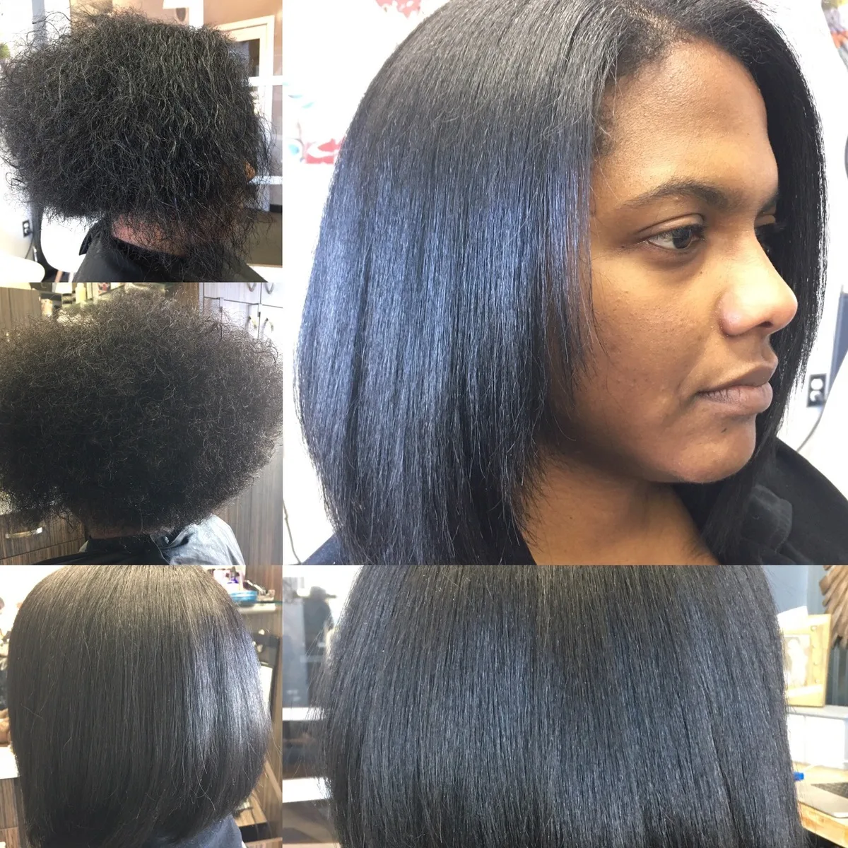 Smoothing treatment before and after